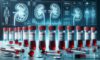 Kidney Blood Test Essentials in Blackburn: A Quick Guide